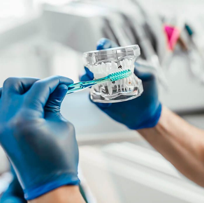 The Dos and Don’ts of Teeth Whitening: Expert Advice (Demo)